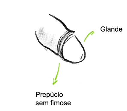 Prepúcio sem fimose